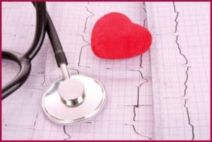 Трансмуральный инфаркт миокарда кардиограмма thumbnail