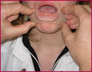 Измерение пульса над губой