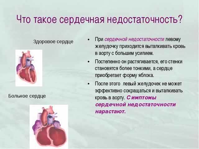 Таблетки от сердечной недостаточности